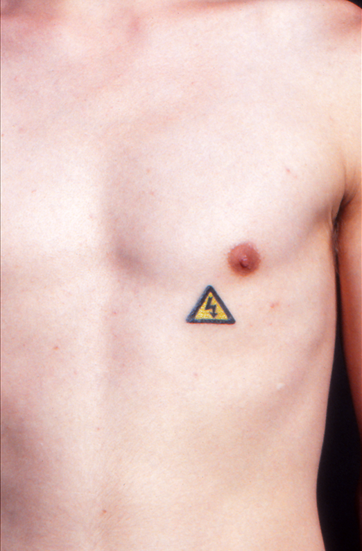 Photograph of tattoo, 1990